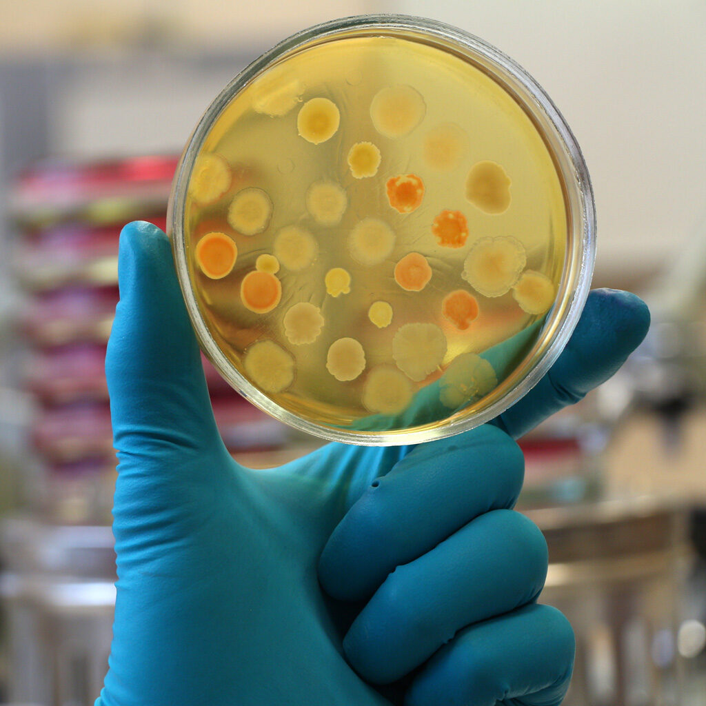 Picture of a technician’s hand holding a petri plaque. Bioburden for medical device testing. Biofilms for medical device testing. What are biofilms. Medical device safety. Post-treatment patient complications. Bacterial species