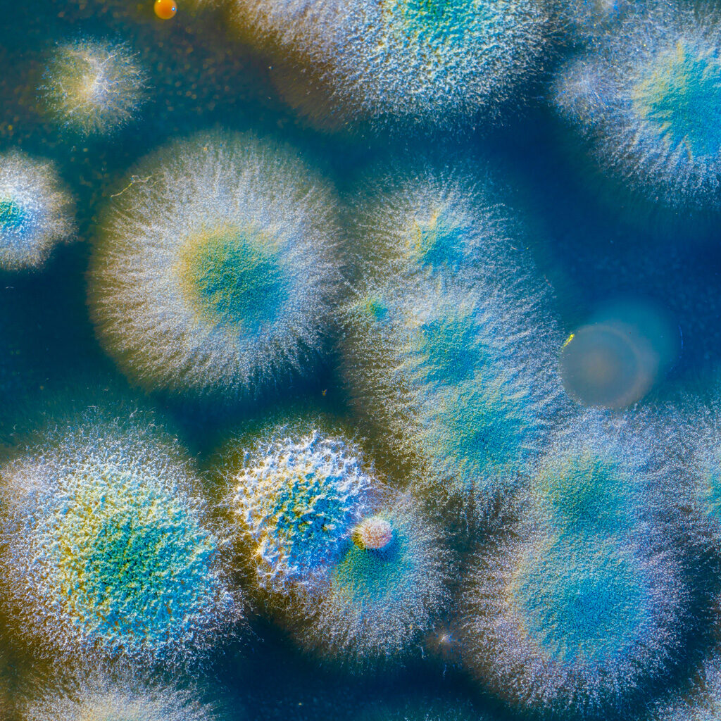 Close picture of a petri plaque with microbes. Sources of microbial contamination. Manufacturing building contamination. Storage building contamination. Equipment contamination. Product contamination. Raw materials contamination. Low-surface microbial contamination. Atmosphere contamination