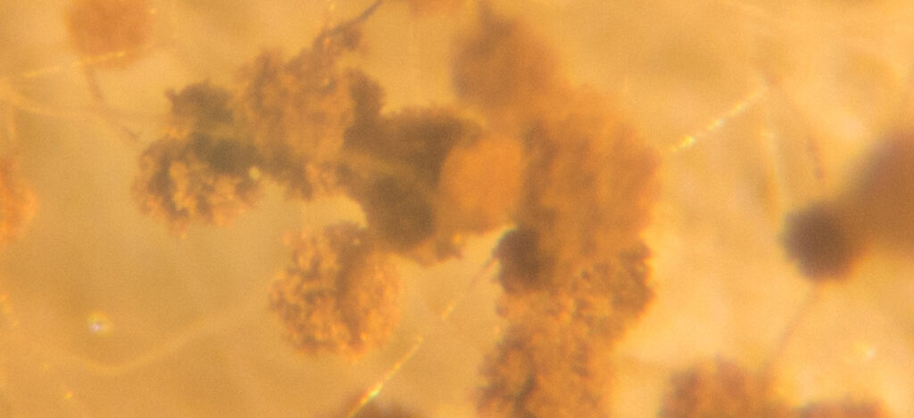 Close picture of an endospore through a microscope. Why are bacterial spores hard to sterilize. What are bacterial spores. Bacterial spore formation. Gram-positive bacteria. Bacterial spores sterilization